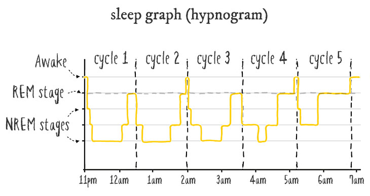 sleep graph hypnogram